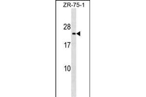 TMED3 Antibody (C-term) (ABIN1536734 and ABIN2849106) western blot analysis in ZR-75-1 cell line lysates (35 μg/lane). (TMED3 anticorps  (C-Term))