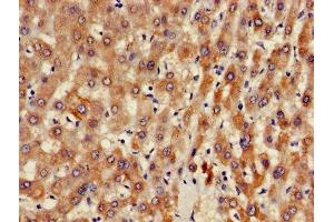 Immunohistochemistry of paraffin-embedded human liver tissue using ABIN7144576 at dilution of 1:100 (ARFIP2 anticorps  (AA 20-295))