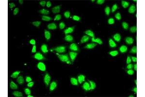 Immunofluorescence analysis of MCF-7 cell using PSMC3 antibody.