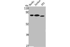 Western Blot analysis of HuvEc Jurkat NIH-3T3 cells using Ezrin Polyclonal Antibody
