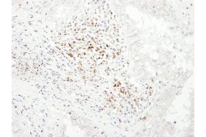 Immunohistochemistry (IHC) image for anti-CD3 epsilon (CD3E) (AA 157-207) antibody (ABIN7453426)
