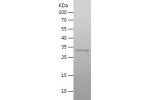 Western Blotting (WB) image for Translocase of Outer Mitochondrial Membrane 40 Homolog (TOMM40) (AA 1-73) protein (His-IF2DI Tag) (ABIN7125473)