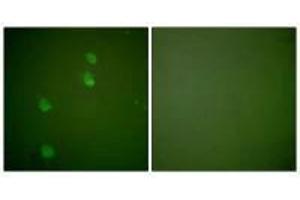 Immunofluorescence analysis of NIH/3T3 cells, using Cullin 2 antibody.
