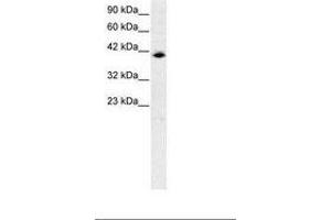 Image no. 1 for anti-Interferon Regulatory Factor 9 (IRF9) (AA 41-90) antibody (ABIN6735770) (IRF9 anticorps  (AA 41-90))