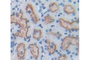 Used in DAB staining on fromalin fixed paraffin- embedded Kidney tissue (ENPP2 anticorps  (AA 54-254))
