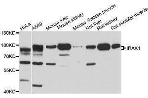 Western blot analysis of extracts of various cell lines, using IRAK1 antibody. (IRAK1 anticorps)