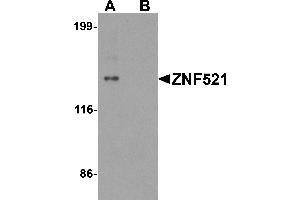 Western blot analysis of ZNF521 in HeLa cell lysate with ZNF521 antibody at 1 µg/mL in (A) the absence and (B) the presence of blocking peptide. (ZNF521 anticorps  (N-Term))