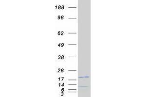 Validation with Western Blot