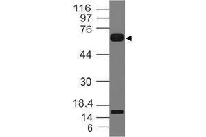 Image no. 1 for anti-Interleukin 1 Receptor-Like 2 (IL1RL2) (AA 1-203) antibody (ABIN5027304) (IL1RL2 anticorps  (AA 1-203))