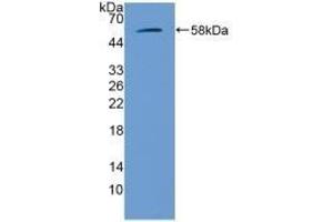 Detection of Recombinant GbA, Mouse using Polyclonal Antibody to Glucocerebrosidase (GBA) (GBA anticorps  (AA 255-509))