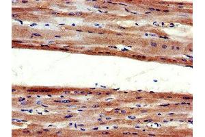 Immunohistochemistry of paraffin-embedded human heart tissue using ABIN7173980 at dilution of 1:100 (Angiotensin II Type-1 Receptor anticorps  (AA 306-356))