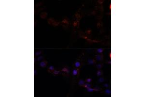 Immunofluorescence analysis of  cells using C antibody (ABIN7266034) at dilution of 1:100. (Calpain 7 anticorps  (AA 20-220))