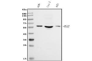 anti-RNA Binding Motif Protein 47 (RBM47) (AA 66-317) antibody