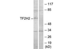 Western blot analysis of extracts from COLO205 cells, using TF2H2 Antibody. (GTF2H2 anticorps  (AA 1-50))