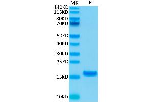 Human IL-21 on Tris-Bis PAGE under reduced condition. (IL-21 Protéine)