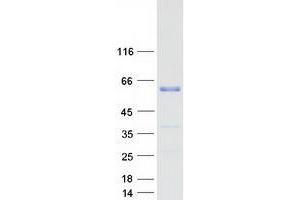 Validation with Western Blot