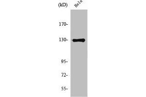 Western Blot analysis of HeLa cells using NOS2 Polyclonal Antibody (NOS2 anticorps  (C-Term))