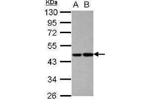 WB Image Sample (30 ug of whole cell lysate) A: HepG2 B: HCT116 10% SDS PAGE antibody diluted at 1:1000 (PROC anticorps)
