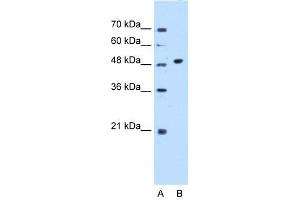 WB Suggested Anti-GTDC1 Antibody Titration:  0. (GTDC1 anticorps  (N-Term))