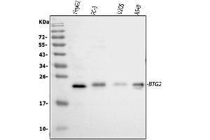 Western blot analysis of BTG2 using anti-BTG2 antibody (ABIN5692800). (BTG2 anticorps)