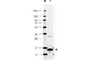 Image no. 1 for anti-Colony Stimulating Factor 2 (Granulocyte-Macrophage) (CSF2) antibody (ABIN401109) (GM-CSF anticorps)