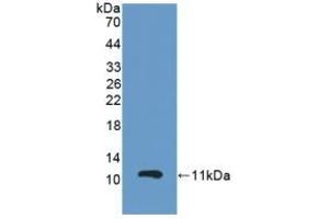 Detection of Recombinant GPX3, Mouse using Polyclonal Antibody to Glutathione Peroxidase 3, Plasma (GPX3)