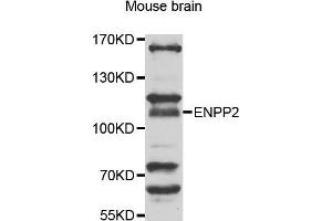 Western Blotting (WB) image for anti-Ectonucleotide Pyrophosphatase/phosphodiesterase 2 (ENPP2) (AA 564-863) antibody (ABIN6219607) (ENPP2 anticorps  (AA 564-863))