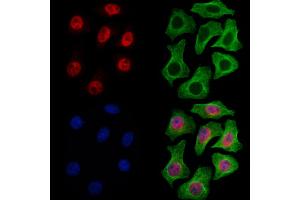 ABIN7094825 and ABIN7098876 staining Hela cells by IF/ICC. (RECQL5 anticorps  (C-Term))