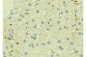 ABIN6277274 at 1/100 staining Mouse liver tissue by IHC-P. (TGFBI anticorps  (N-Term))