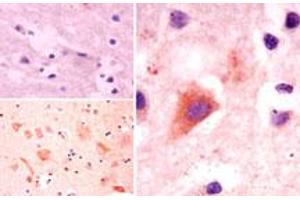 Image no. 1 for anti-Autophagy Related 10 (ATG10) (AA 1-50) antibody (ABIN960090)