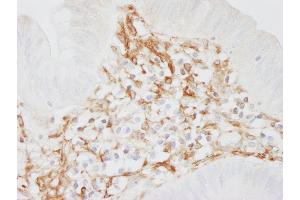 Immunohistochemistry (IHC) image for anti-Filamin A, alpha (FLNA) (AA 2597-2647) antibody (ABIN7454721)