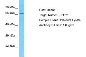 Host: Rabbit Target Name: SH3D21 Sample Tissue: Human Placenta Antibody Dilution: 1ug/ml (SH3D21 anticorps  (C-Term))