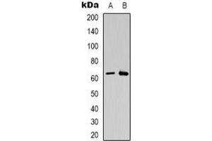 Western blot analysis of CSGALNACT2 expression in K562 (A), Jurkat (B) whole cell lysates. (CSGALNACT2 anticorps)