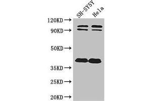 Western Blot Positive WB detected in: SH-SY5Y whole cell lysate, Hela whole cell lysate All lanes: DISC1 antibody at 2 μg/mL Secondary Goat polyclonal to rabbit IgG at 1/50000 dilution Predicted band size: 94, 92, 74, 39, 83, 63, 61, 76, 73, 38, 22 kDa Observed band size: 94, 92, 38 kDa (DISC1 anticorps  (AA 99-325))