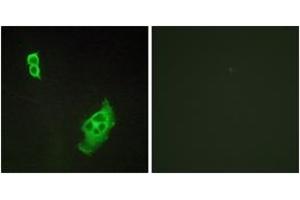 Immunofluorescence analysis of COS7 cells, using WAVE1 (Ab-125) Antibody. (WASF1 anticorps  (AA 91-140))