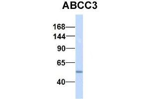 Host:  Rabbit  Target Name:  NSUN6  Sample Type:  Human Fetal Lung  Antibody Dilution:  1. (ABCC3 anticorps  (Middle Region))