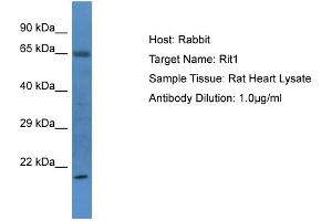 Host: Rabbit Target Name: Rit1 Sample Type: Rat Heart lysates Antibody Dilution: 1. (RIT1 anticorps  (N-Term))