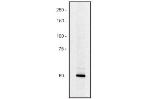 Western blot of human REH erythroid cell line (PCLO anticorps)