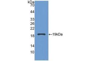 Detection of Recombinant GCA, Human using Polyclonal Antibody to Grancalcin (GCA) (Grancalcin anticorps  (AA 1-139))