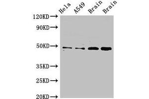 Western Blot Positive WB detected in: Hela whole cell lysate, A549 whole cell lysate, Rat brain tissue, Mouse brain tissue All lanes: GJA8 antibody at 2. (GJA8 anticorps  (AA 286-432))
