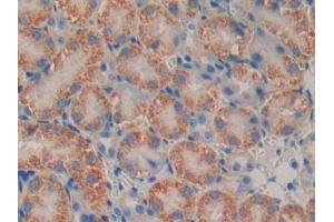 DAB staining on IHC-P; Samples: Mouse Kidney Tissue (PSMB9 anticorps  (AA 22-219))