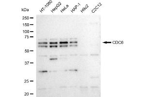 Western blotting analysis using CDC6 antibody (ABIN7798016).