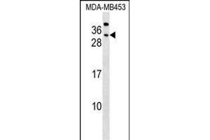 CEAC Antibody (Center) (ABIN1537760 and ABIN2848792) western blot analysis in MDA-M cell line lysates (35 μg/lane). (CEACAM7 anticorps  (AA 112-140))