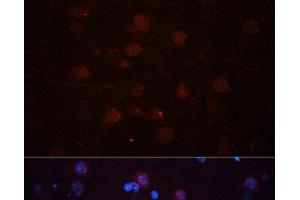 Immunofluorescence analysis of Rat brain using ASPN Polyclonal Antibody at dilution of 1:100 (40x lens). (Asporin anticorps)