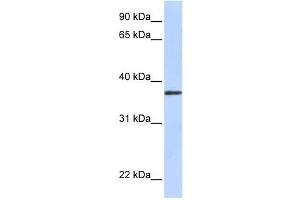 Western Blotting (WB) image for anti-Transmembrane Protein 200B (TMEM200B) antibody (ABIN2458847) (TMEM200B anticorps)
