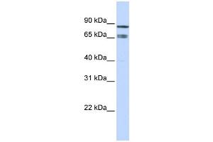 WB Suggested Anti-IKZF1 Antibody Titration:  0.