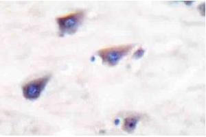 Image no. 2 for anti-Glutamate Receptor, Metabotropic 8 (GRM8) antibody (ABIN265441) (GRM8 anticorps)
