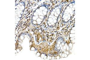 Immunohistochemistry of paraffin-embedded rat liver using Phospho--S473 Rabbit mAb (ABIN6135179, ABIN6135970, ABIN6135971 and ABIN7101880) at dilution of 1:100 (40x lens). (AKT1 anticorps  (pSer473))