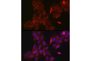 Immunofluorescence analysis of PC-12 cells using NLRP1 antibody (ABIN7268935) at dilution of 1:200.