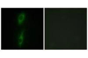 Immunofluorescence analysis of HeLa cells, using ACVL1 antibody.